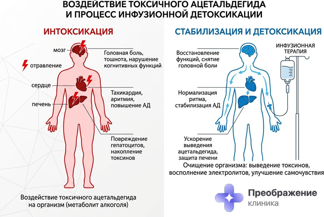 Инфографика: воздействие токсичного ацетальдегида на органы и процесс инфузионной детоксикации